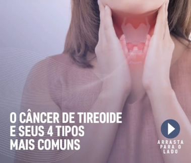 CONTEUDO